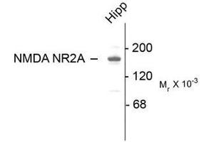 Image no. 1 for anti-Glutamate Receptor, Ionotropic, N-Methyl D-Aspartate 2a (GRIN2A) (C-Term) antibody (ABIN372679) (NMDAR2A anticorps  (C-Term))