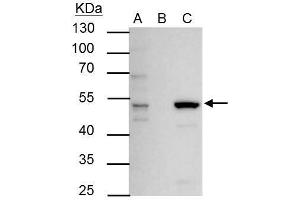 IP Image ERR alpha antibody immunoprecipitates ERR alpha protein in IP experiments.