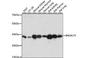 Western blot analysis of extracts of various cell lines, using B4G antibody (ABIN7271200) at 1:1000 dilution. (B4GALT4 anticorps  (AA 35-344))