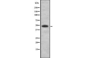 Western blot analysis of MAGEA1 using K562 whole cell lysates (MAGEA1 anticorps  (N-Term))