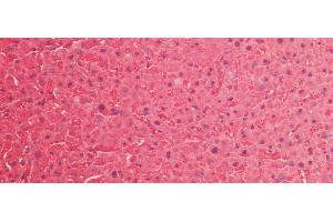 Detection of SOD1 in Human Liver Tissue using Polyclonal Antibody to Superoxide Dismutase 1 (SOD1) (SOD1 anticorps  (AA 2-153))