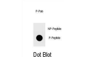 Dot blot analysis of Phospho-FAH1B2-S64 antibody Phospho-specific b (ABIN1539706 and ABIN2839839) on nitrocellulose membrane. (PAFAH1B2 anticorps  (AA 41-70))