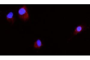 IF analysis of Beta 2 Microglobulin/B2m using anti-Beta 2 Microglobulin/B2m antibody (ABIN7600594).