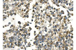 IHC analysis of AKR7A2 using anti-AKR7A2 antibody (ABIN7601157).