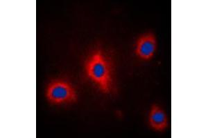 Immunofluorescent analysis of GRB10 (pY67) staining in PC12 cells.