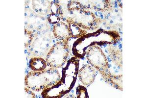 Immunohistochemistry of paraffin-embedded Rat kidney using EML4 Rabbit pAb (ABIN7266891) at dilution of 1:100 (40x lens).