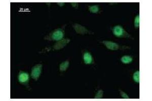 Immunostaining analysis in HeLa cells. (ZNF384 anticorps)