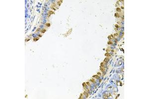 Immunohistochemistry of paraffin-embedded mouse lung using KLK11 antibody (ABIN6129404, ABIN6142947, ABIN6142949 and ABIN6222337) at dilution of 1:100 (40x lens). (Kallikrein 11 anticorps  (AA 1-250))