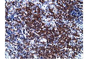 Immunohistochemical staining of paraffin-embedded Human lymph node tissue using anti-PIK3AP1 mouse monoclonal antibody. (PIK3AP1 anticorps)