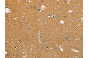 The image on the left is immunohistochemistry of paraffin-embedded Human brain tissue using ABIN7191634(NFASC Antibody) at dilution 1/30, on the right is treated with synthetic peptide. (NFASC anticorps)