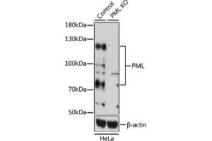 Western blot analysis of extracts from normal (control) and PML knockout (KO) HeLa cells, using PML antibody (ABIN3021658, ABIN3021659, ABIN3021660, ABIN1513388 and ABIN1514534) at 1:1000 dilution. (PML anticorps  (AA 300-600))
