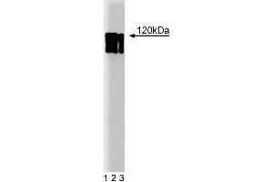 Western blot analysis of HIF-1alpha on lysate from HeLa stimulated with CoCl2, cobalt chloride. (HIF1A anticorps  (AA 610-727))