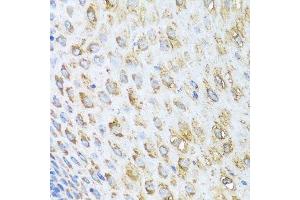 Immunohistochemistry of paraffin-embedded human esophagus using STK4 antibody.
