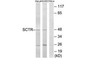 Western blot analysis of extracts from HeLa/HuvEc cells, using SCTR Antibody. (SCTR anticorps  (AA 100-149))