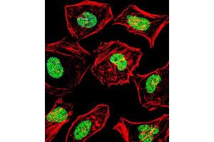 Immunofluorescence (IF) image for anti-Heart and Neural Crest Derivatives Expressed 2 (HAND2) antibody (ABIN2999145)