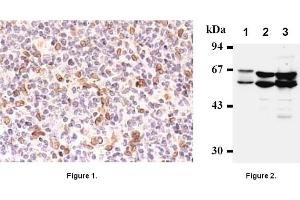 Immunohistochemistry (IHC) image for anti-Cell Division Cycle 25 Homolog A (S. Pombe) (CDC25A) antibody (ABIN487337)