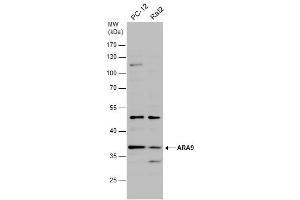 WB Image Various whole cell extracts (30 μg) were separated by 10% SDS-PAGE, and the membrane was blotted with ARA9 antibody [N1C3] , diluted at 1:500. (AIP anticorps)