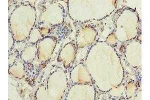 Immunohistochemistry of paraffin-embedded human thyroid tissue using ABIN7168256 at dilution of 1:100 (RNF24 anticorps  (AA 45-148))