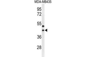 Western Blotting (WB) image for anti-G Protein-Coupled Receptor 17 (GPR17) antibody (ABIN3004347) (GPR17 anticorps)