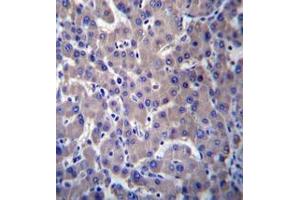 Immunohistochemistry analysis in human liver tissue (formalin-fixed, paraffin-embedded) using GPR34  Antibody , followed by peroxidase conjugation of the secondary antibody and DAB staining.