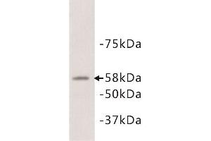 Western Blotting (WB) image for anti-Alkaline Phosphatase (ALP) antibody (ABIN1854820) (Alkaline Phosphatase anticorps)
