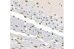 Immunohistochemistry of paraffin embedded mouse brain using Transketolase (ABIN7075978) at dilution of 1: 2200 (400x lens)
