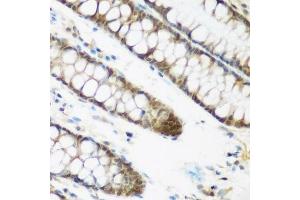 Immunohistochemistry of paraffin-embedded human colon using NCBP2 antibody.