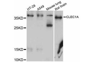 Western blot analysis of extracts of various cell lines, using CLEC1A antibody (ABIN5997458) at 1/1000 dilution. (CLEC1A anticorps)