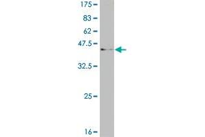 Western Blot detection against Immunogen (37.