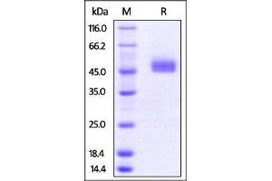 Mouse TIGIT, Fc Tag on SDS-PAGE under reducing (R) condition.
