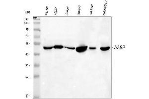 anti-Wiskott-Aldrich Syndrome (Eczema-thrombocytopenia) (WAS) (AA 129-156), (C-Term) antibody