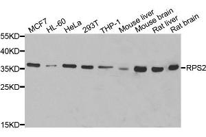 Western blot analysis of extracts of various cell lines, using RPS2 antibody.