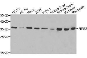 Western blot analysis of extracts of various cell lines, using RPS2 antibody. (RPS2 anticorps  (AA 1-293))