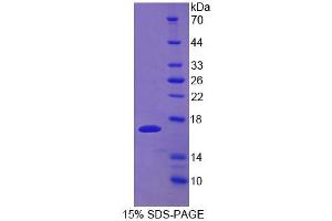 SDS-PAGE analysis of Mouse UPK1A Protein. (UPK1A Protéine)