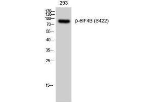 Western Blotting (WB) image for anti-Eukaryotic Translation Initiation Factor 4B (EIF4B) (pSer422) antibody (ABIN3182179) (EIF4B anticorps  (pSer422))
