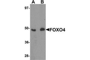Western blot analysis of FOXO4 in HeLa cell lysate with FOXO4 antibody at (A) 0. (FOXO4 anticorps  (N-Term))