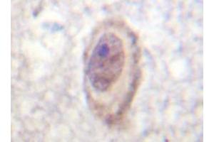 Immunohistochemistry analyzes of C-Raf antibody in paraffin-embedded human brain tissue. (RAF1 anticorps)