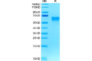 Biotinylated Human B7-H4 on Tris-Bis PAGE under reduced condition. (VTCN1 Protein (His-Avi Tag,Biotin))