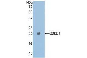 Detection of Recombinant CPE, Human using Polyclonal Antibody to Carboxypeptidase E (CPE)