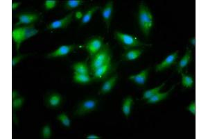 Immunofluorescence staining of Hela cells with ABIN7160821 at 1:133, counter-stained with DAPI. (NLRP1 anticorps  (AA 589-655))