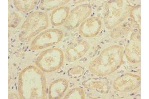 Immunohistochemistry of paraffin-embedded human kidney tissue using ABIN7150306 at dilution of 1:100 (DNA2 anticorps  (AA 1-300))