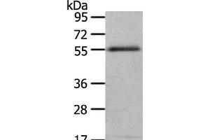 Western Blot analysis of 293T cell using ENPP7 Polyclonal Antibody at dilution of 1:700