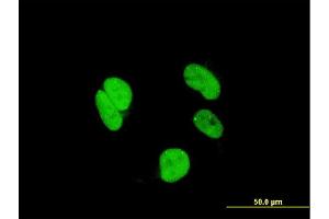 Immunofluorescence of monoclonal antibody to RAX on HeLa cell. (RAX anticorps  (AA 104-206))