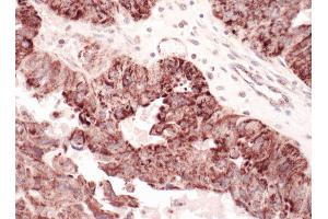 Immunohistochemistry (IHC) image for anti-Complement Component 1, Q Subcomponent Binding Protein (C1QBP) (AA 232-282) antibody (ABIN7453535)