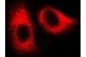 Immunofluorescent analysis of HSPA1L staining in U2OS cells.