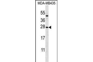 KLRC1 Antibody (N-term) (ABIN656501 and ABIN2845775) western blot analysis in MDA-M cell line lysates (35 μg/lane). (KLRC1 anticorps  (N-Term))