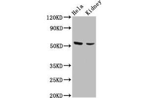 Western Blot Positive WB detected in: Hela whole cell lysate, Mouse kidney tissue All lanes: POLK antibody at 4. (POLK anticorps  (AA 227-337))