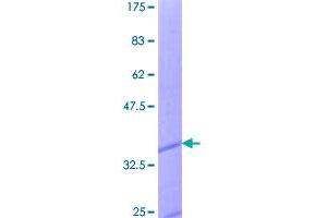 Image no. 1 for Chemokine (C-C Motif) Ligand 1 (CCL1) (AA 1-96) protein (GST tag) (ABIN1348360)