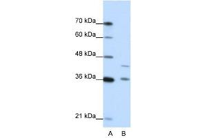 NKD2 antibody used at 0. (NKD2 anticorps)
