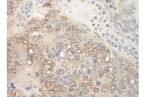 Immunohistochemistry (IHC) image for anti-Zinc Finger, CCHC Domain Containing 11 (ZCCHC11) (AA 250-300) antibody (ABIN7448876) (ZCCHC11 anticorps  (AA 250-300))